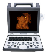 SIUI Apogee 2100 Ultrasound For Sale