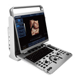 Chison EBit 30 Portable Ultrasound For Sale