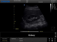 Chison ECO3 Expert Ultrasound For Sale