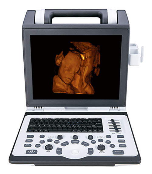 SIUI Apogee 2100 Ultrasound For Sale