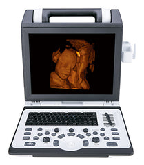 SIUI Apogee 2100 Ultrasound For Sale