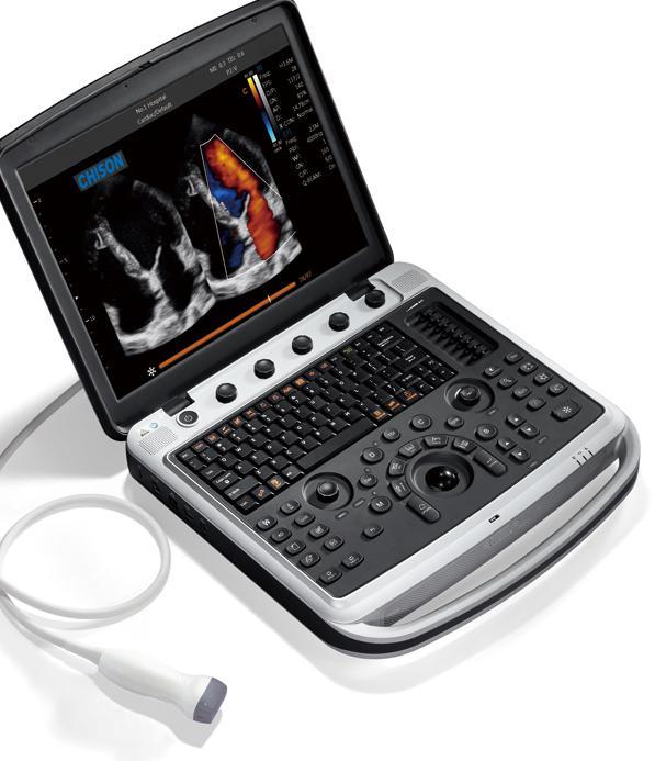 Chison SonoBook 9 Ultrasound For Sale