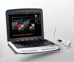 Chison SonoBook 9 Ultrasound For Sale