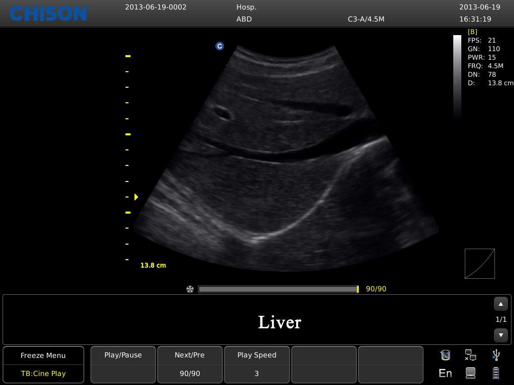 Chison ECO3 Expert Ultrasound For Sale