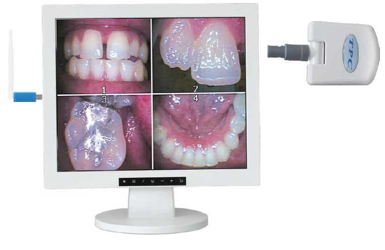 AIC2IN1W 17" Flat Screen Monitor Multi-Media w/AIC5855A Intra-oral Camera Pkg