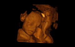 SIUI Apogee 2100 Ultrasound For Sale