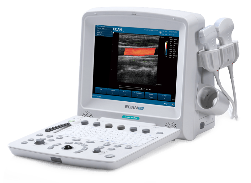 EDAN U50 Prime Ultrasound For Sale