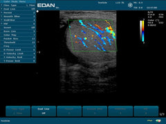 EDAN U50 Prime Ultrasound For Sale