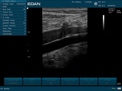 EDAN U50 Prime Ultrasound For Sale