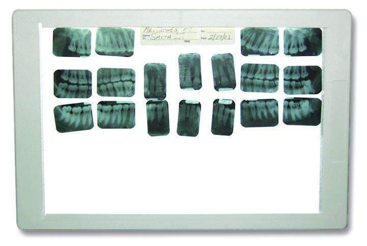 TPC Dental XV100-TUV Super Thin X-ray Viewer (w/Euro Adaptor)